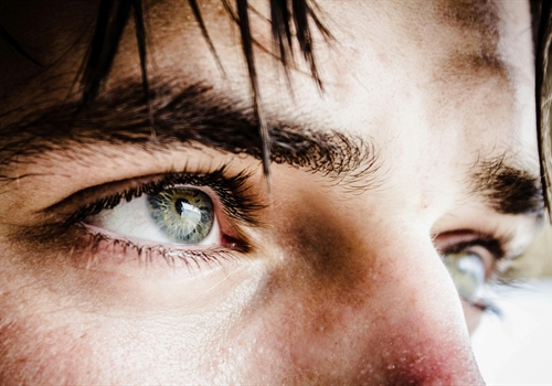 Underlying causes of wrinkled skin Underlying causes of wrinkled skin